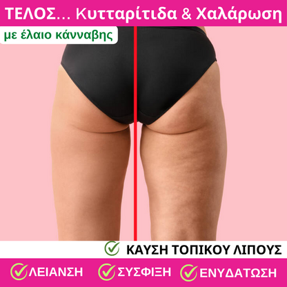 Κρέμα κατά της Kυτταρίτιδας & Χαλάρωσης  200 ml